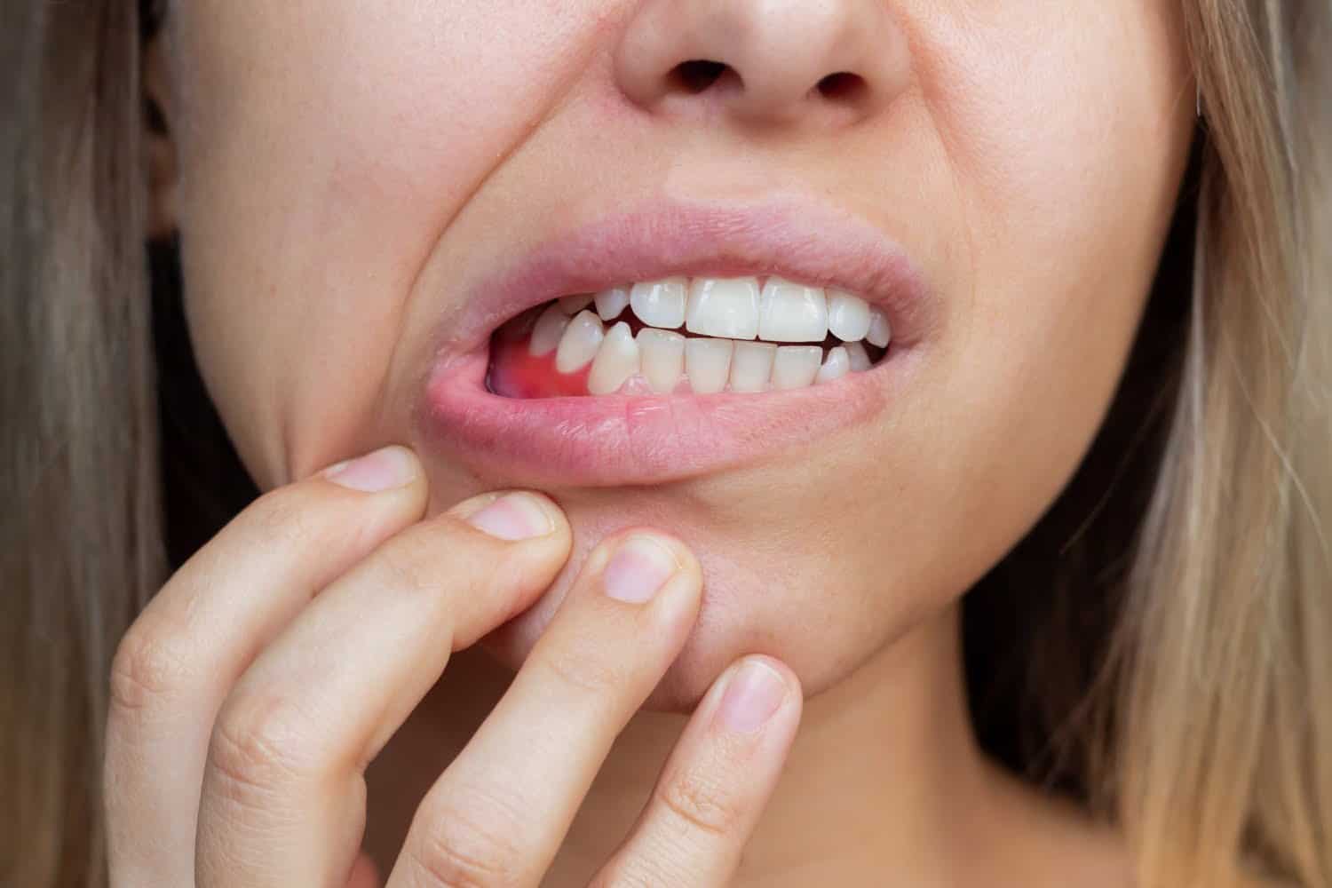 Arrêter de grincer des dents : 10 stratégies efficaces