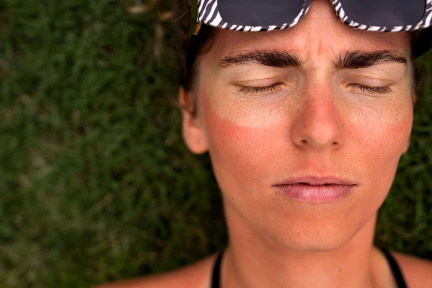Le soleil : allié sous conditions, 5 menaces à connaître et réflexes à adopter