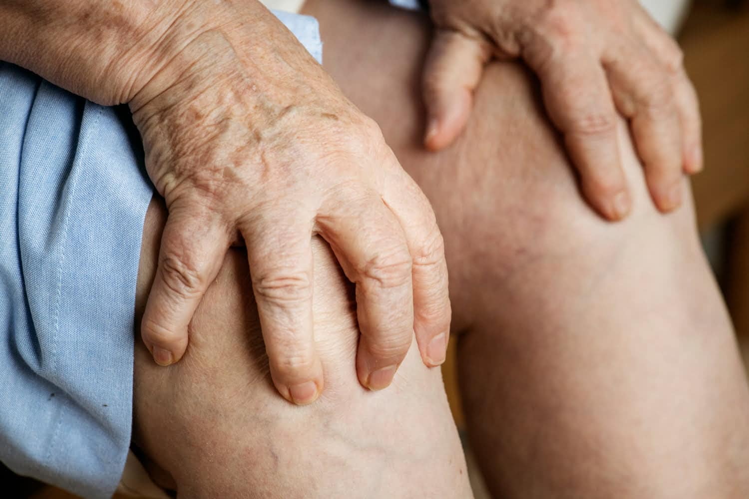 Les taches de vieillesse sur les jambes :