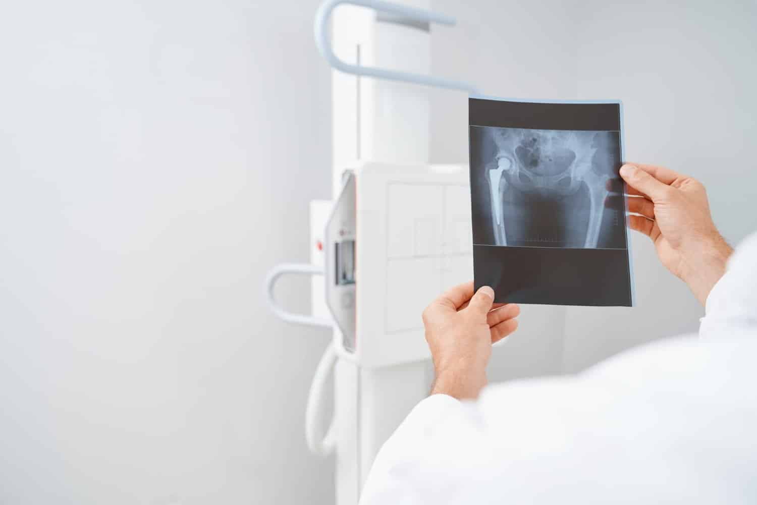Scanner et cancer : une étude avance un risque