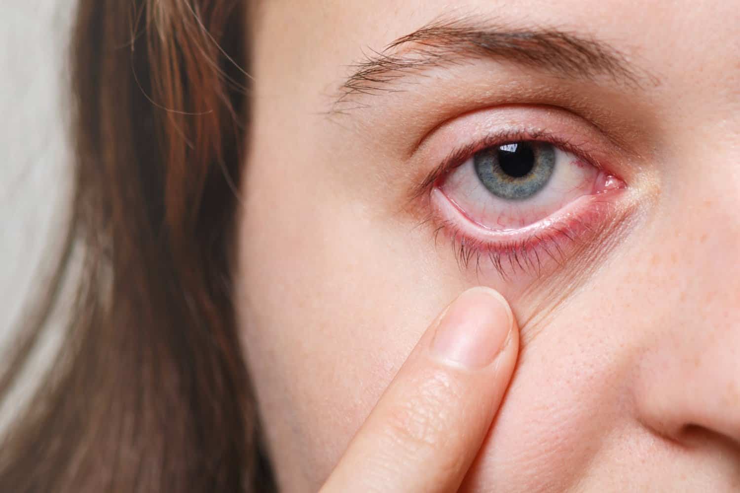 Douleur à l’œil : 10 causes courantes