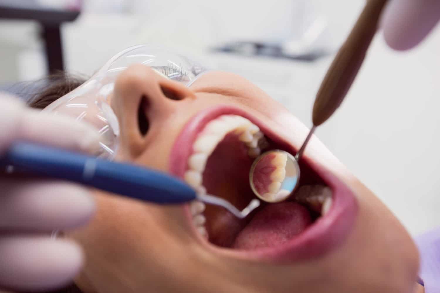 Rendez-vous chez le dentiste : tous les combien y aller ?