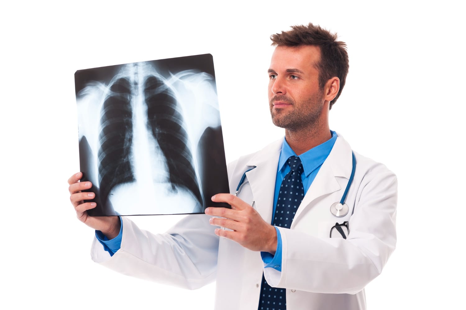 Cancer du poumon chez les non-fumeurs : les hypothèses de scientifiques